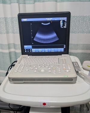 alat ultrasonografi portabel